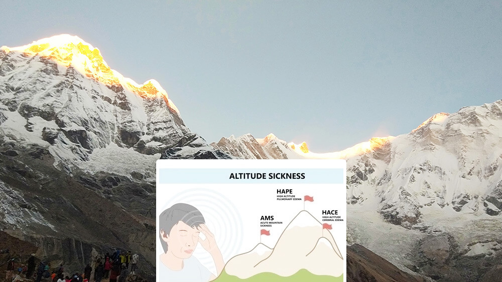 Annapurna Base Camp Trek Altitude Sickness Guide